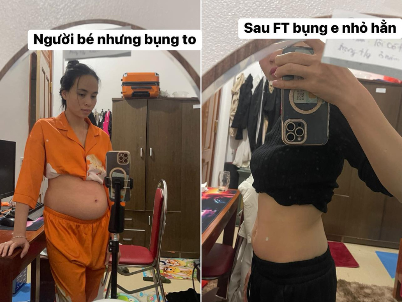 2 Tuần Hết Đau Dạ Dày Mà Không Cần Thuốc – Câu Chuyện Có Thật Của Chị Thanh Lệ!