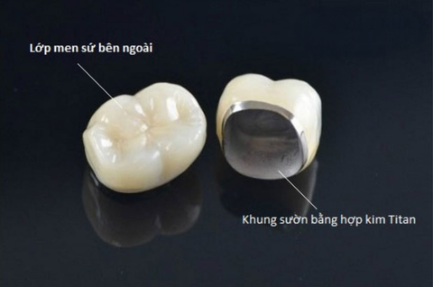 Cấu Tạo Răng Sứ – Bí Mật Đằng Sau Nụ Cười Hoàn Hảo