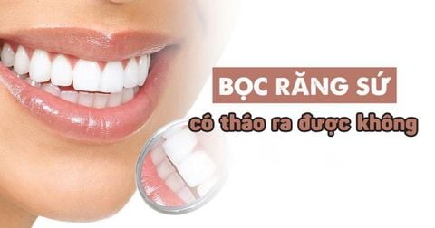 Răng Sứ Có Tháo Ra Được Không? Giải Đáp Từ Nha Khoa Siam Dental
