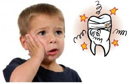 Điều Gì Xảy Ra Khi Trẻ Không Được Lấy Tủy Răng Sữa Kịp Thời?