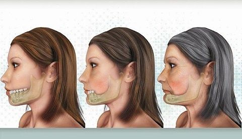 Bọc Răng Sứ Chỉnh Khớp Cắn Có An Toàn Không? Giải Đáp Từ Siam Dental