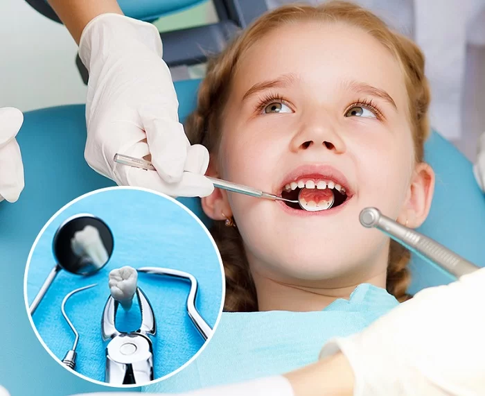 Phục Hình Răng Mất Cho Trẻ Em – Hành Trang Cho Hàm Răng Khỏe Mạnh