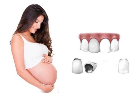Mẹ Bầu Có Nên Bọc Răng Sứ Không? Giải Đáp Từ Nha Khoa Siam Dental