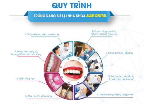 Quy Trình Chế Tạo Răng Sứ Chuẩn Công Nghệ Tại Nha Khoa Siam Dental