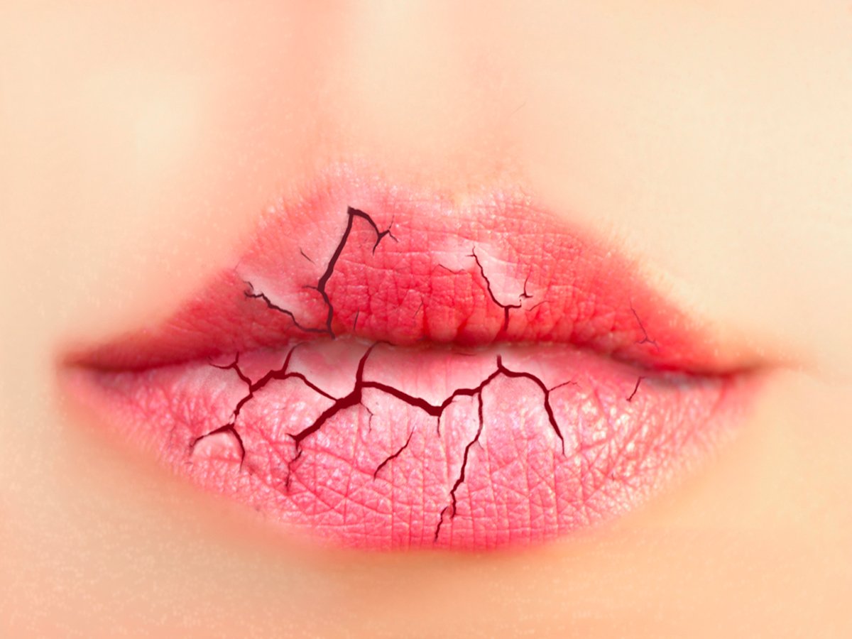 Tìm hiểu cách dưỡng môi khô nứt nẻ hiệu quả
