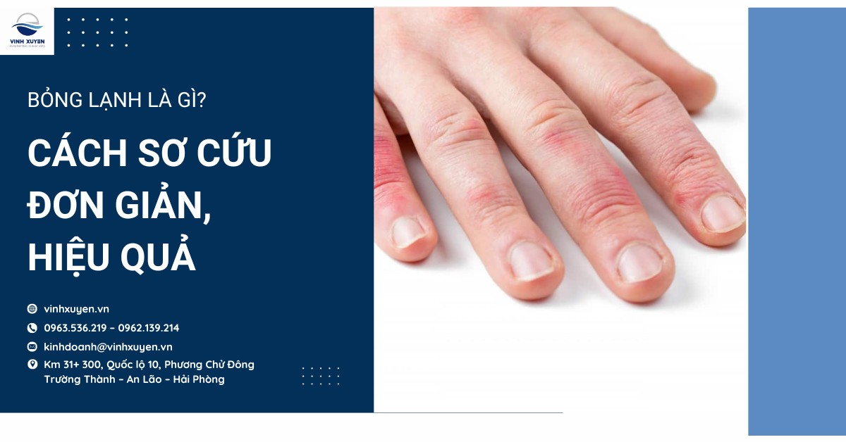 Bỏng lạnh là gì? Cách sơ cứu đơn giản, hiệu quả