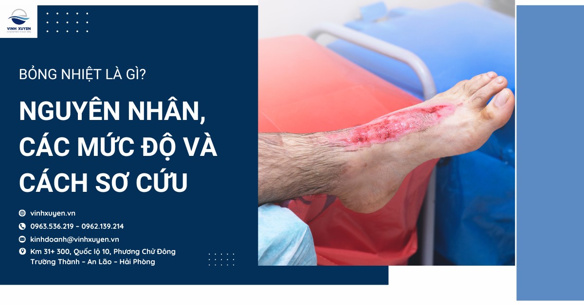 Bỏng nhiệt là gì? Nguyên nhân, các mức độ và cách sơ cứu