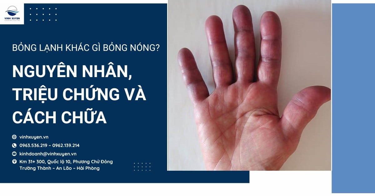 Bỏng lạnh khác gì bỏng nóng? Nguyên nhân, triệu chứng và cách chữa