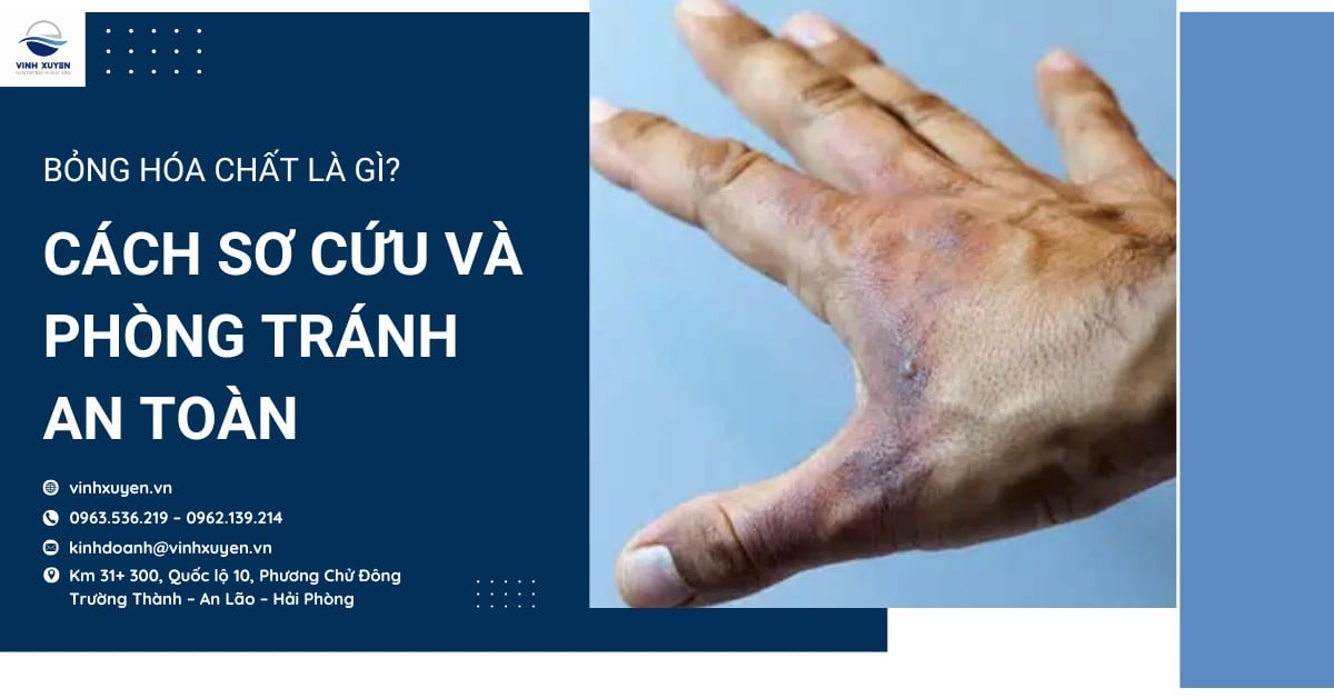 Bỏng hóa chất là gì? Cách sơ cứu và phòng tránh an toàn