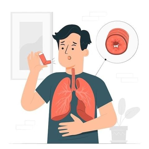Hen suyễn có nên tập gym không ? Tất tần tật về hen suyễn