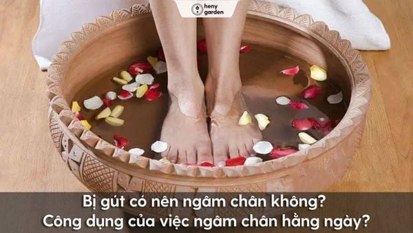 Bệnh Gout Có Nên Ngâm Chân Nước Nóng? Hướng Dẫn Chi Tiết Và Lưu Ý Quan Trọng