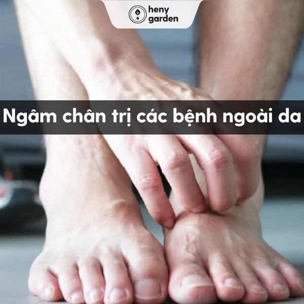 ngâm chân giúp trị các bệnh ngoài da