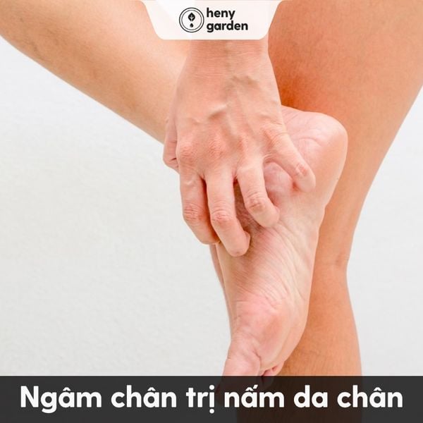 bệnh gì không nên ngâm chân? ngâm chân trị nấm da chân