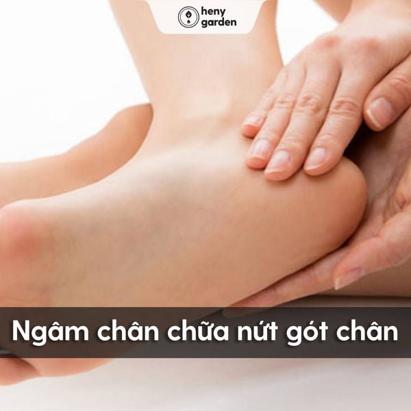 tác dụng của ngâm chân chữa nứt gót