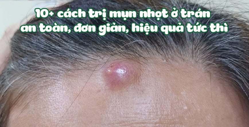 4. Cách phòng ngừa mụn nhọt