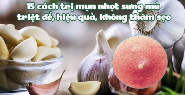 Có cách trị mụn nhọt bằng tỏi nào đơn giản và hiệu quả mà chúng ta có thể thử?
