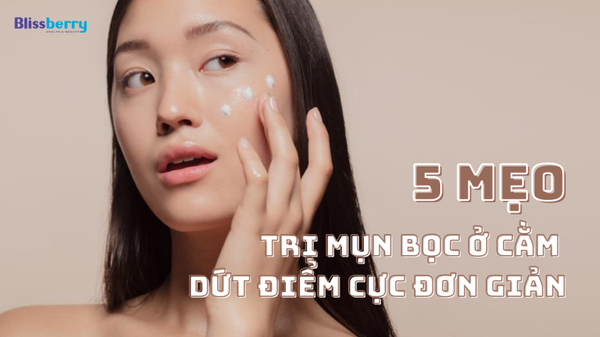 5 mẹo trị mụn bọc ở cằm dứt điểm cực đơn giản cho bạn gái