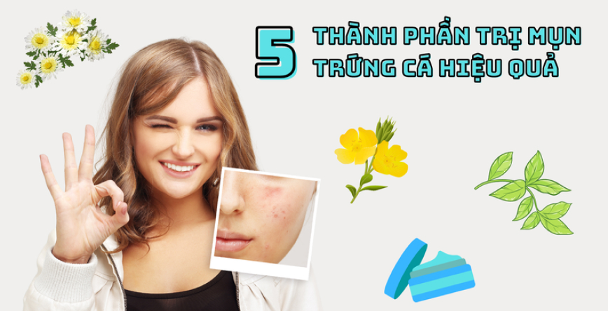 5 Thành phần thiên nhiên trị mụn trứng cá cực hiệu quả bạn nên biết