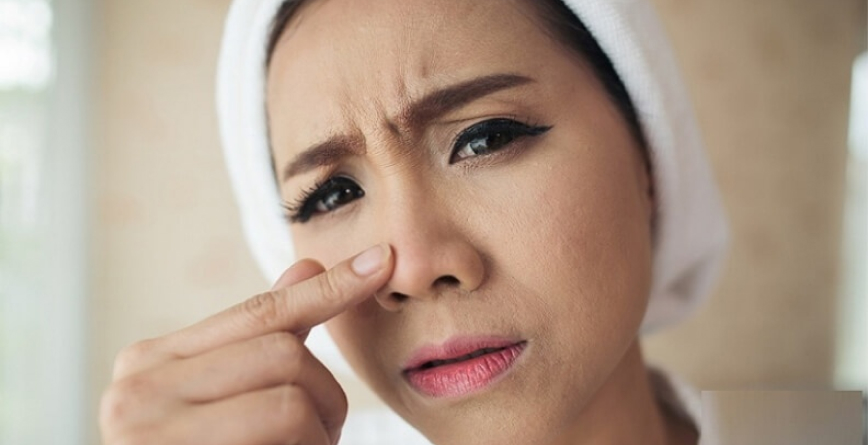 6 cách trị mụn ẩn ở mũi tại nhà đơn giản, an toàn, hiệu quả ngay