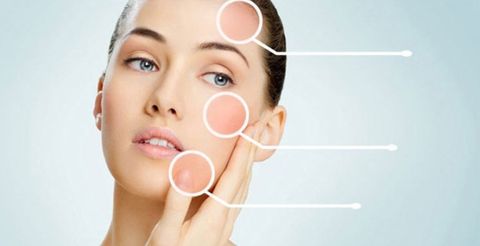 Các loại da mặt: cách nhận biết, chăm sóc da mặt hiệu quả