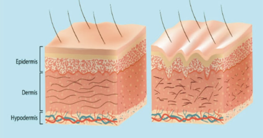 Cấu trúc và chức năng lớp trung bì của da là gì?