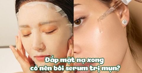 Đắp mặt nạ xong có nên bôi serum trị mụn?