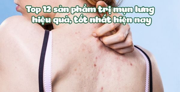 Top 12 sản phẩm trị mụn lưng hiệu quả, tốt nhất hiện nay