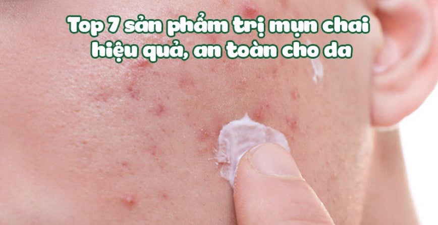 Top 7 sản phẩm trị mụn chai hiệu quả, an toàn cho da