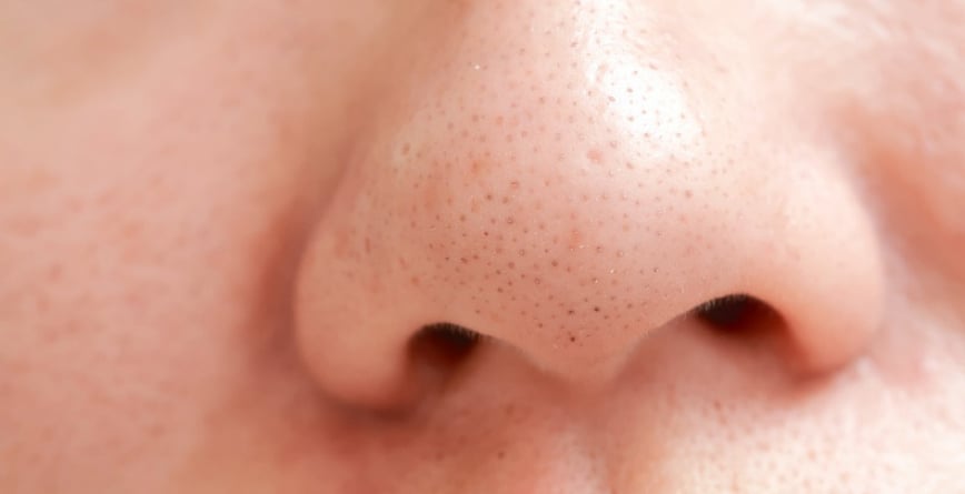 Top 7 sản phẩm trị mụn đầu đen ở mũi hiệu quả, an toàn cho da