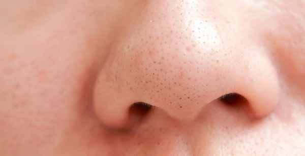 Nếu có mụn đầu đen ở mũi, có nên sử dụng BHA tự nhiên hay BHA hóa học?
