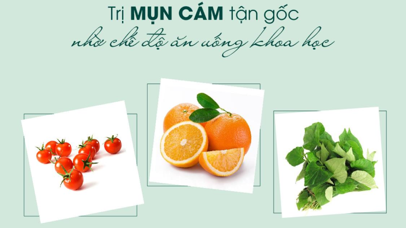 Top 7 thực phẩm cải thiện mụn cám từ bên trong