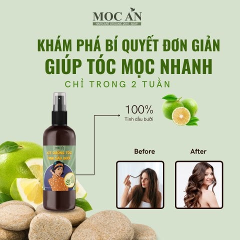 Cách mọc tóc nhanh hiệu quả chỉ trong 2 tuần