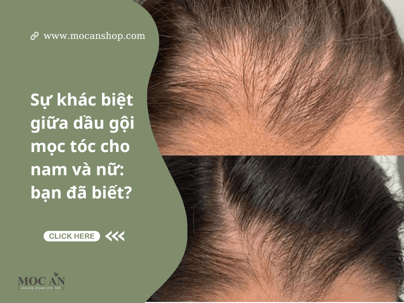 Sự khác biệt giữa dầu gội mọc tóc cho nam và nữ: bạn đã biết?