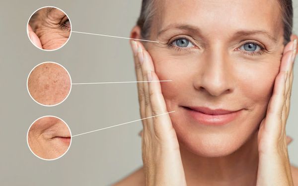 Chức năng chính của kem chống nắng