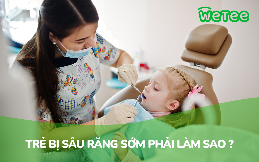 Trẻ bị sâu răng sớm phải làm sao?