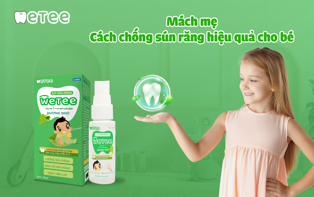 Mách mẹ cách chống sún răng hiệu quả cho bé