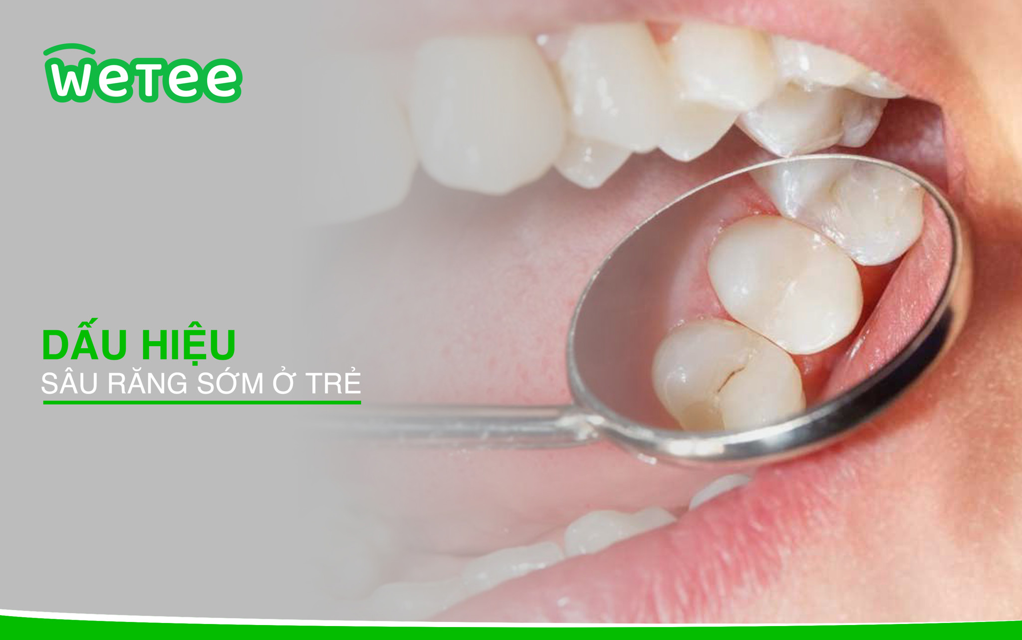 Sâu răng sớm