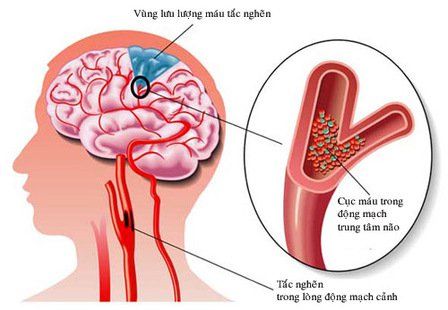 Hình ảnh bài viết
