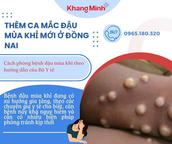 Hình ảnh bài viết