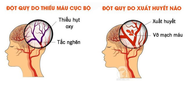 Hình ảnh bài viết