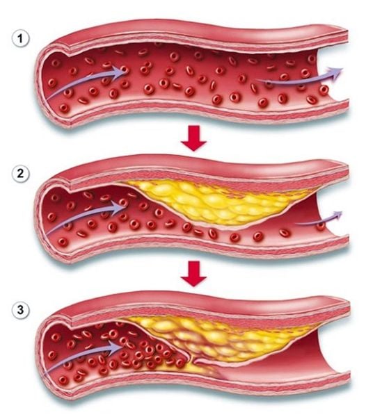 Hình ảnh bài viết