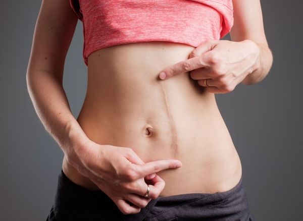 Các tiêu chí chọn thuốc trị sẹo phù hợp