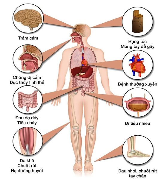 Các triệu chứng khi thiếu hụt canxi
