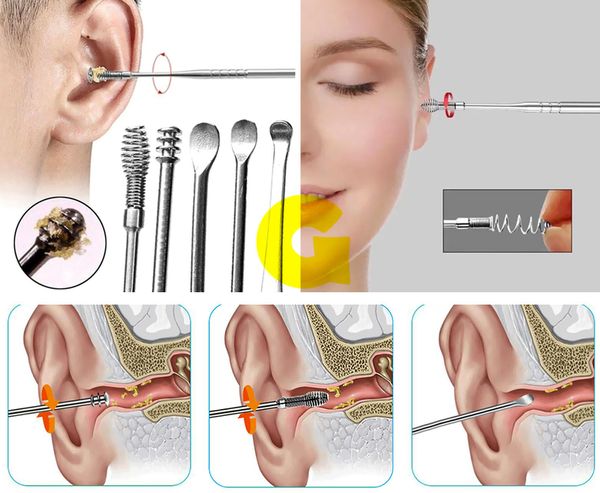 Hình ảnh bài viết