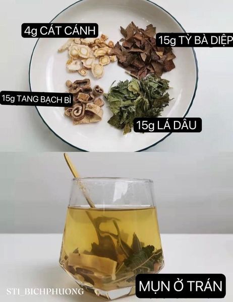 Hình ảnh bài viết