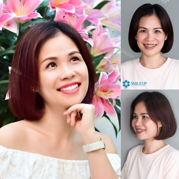 Hình ảnh bài viết