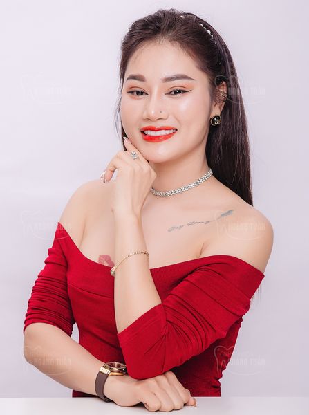 Hình ảnh bài viết