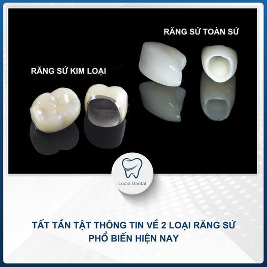 Hình ảnh bài viết