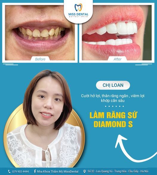 Hình ảnh bài viết