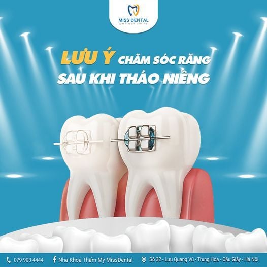 Hình ảnh bài viết